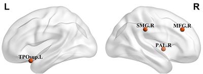 Altered Structural Brain Network Topology in Patients With Primary Craniocervical Dystonia